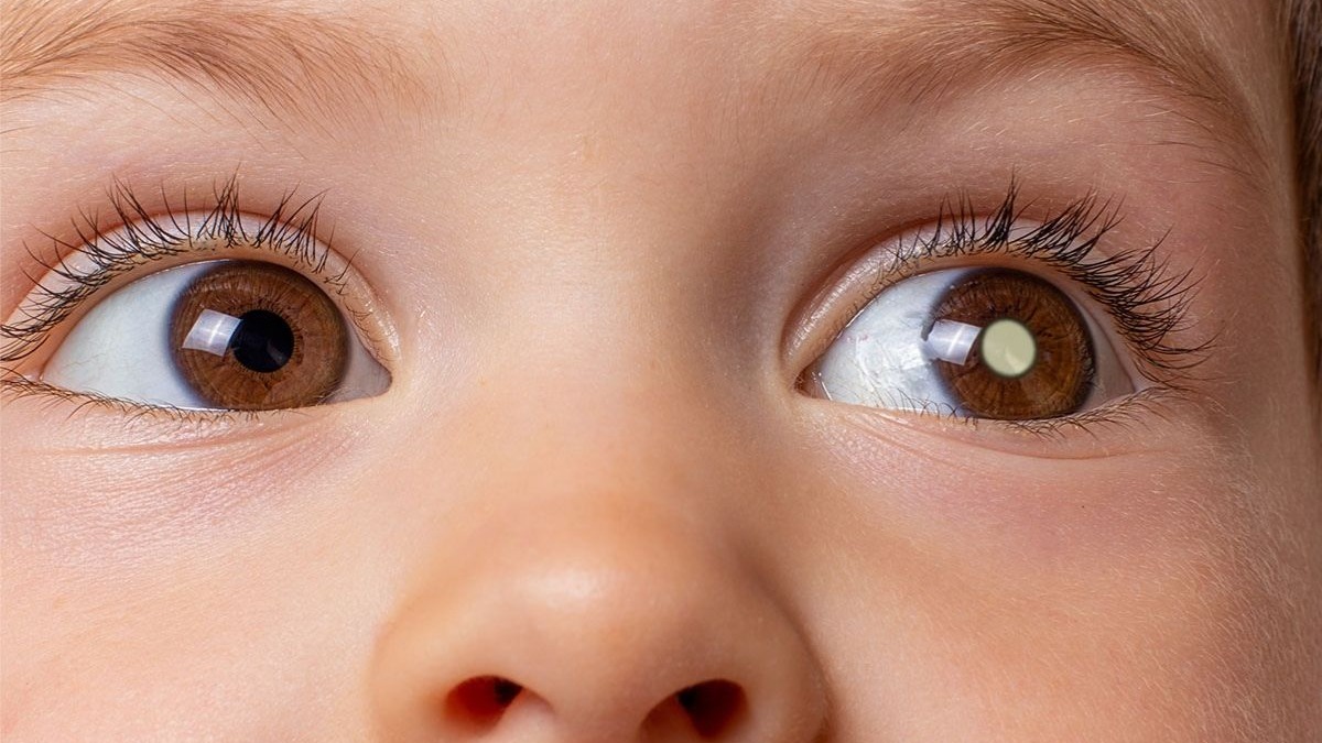 Revolução no Diagnóstico: Teste de Rastreamento Ocular Detecta Autismo em Bebês em Apenas 15 Minutos!